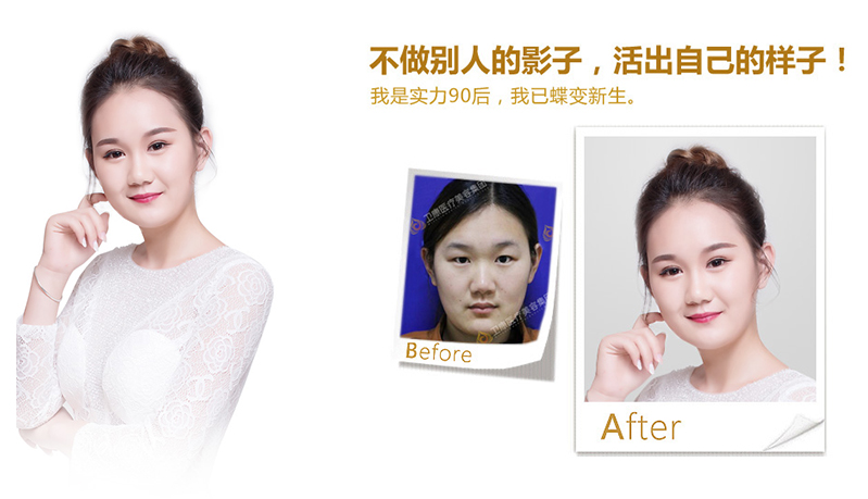 宜昌纳米脂肪移植