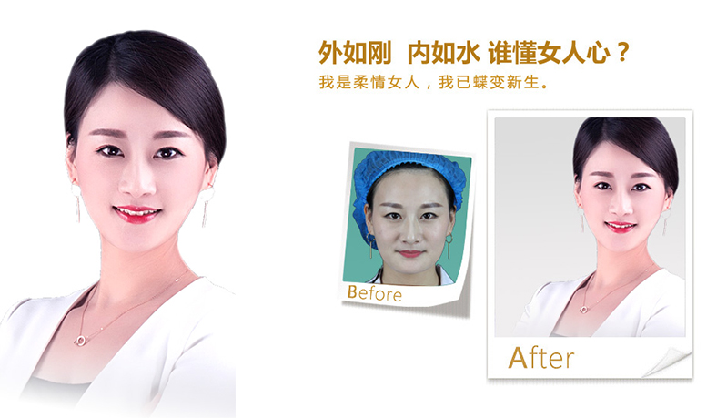 宜昌V脸、线雕隆鼻